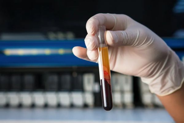 莱森光学：应用于血迹检测的高光谱成像技术研究